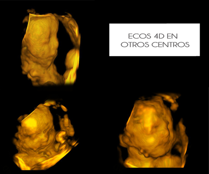 ECO 4D DE OTRO ENTRO