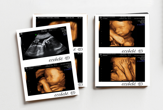 SESIÓN ECOGRAFÍA 5D BASIC - Imagen 4