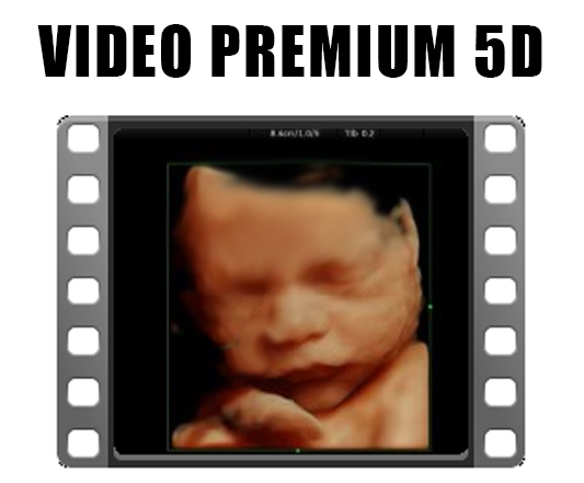 SESIÓN ECOGRAFÍA 5D MES A MES - Imagen 7