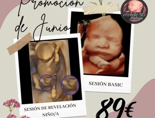 Promoción ecografía 5D Málaga